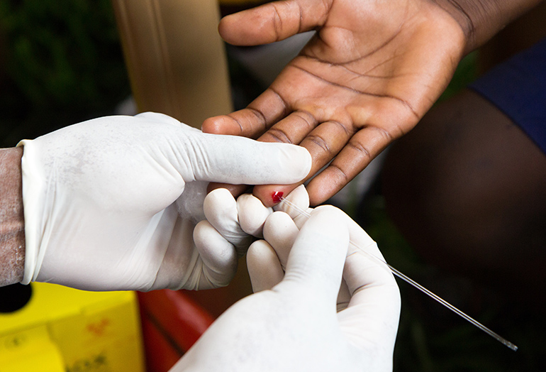 Featured image for “Etude comportementale et biologique chez les professionnelles de sexe et les consommateurs de drogue injectable à Madagascar”